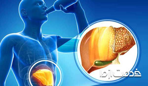آزمایش خون | درمان درمان کبد چرب با فهمیدن به موقع علائم کبد چرب
