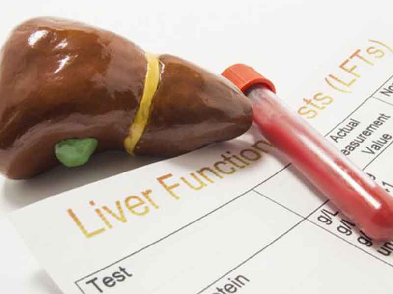 همه چیز در مورد بیماری کبد چرب که باید بدونیم