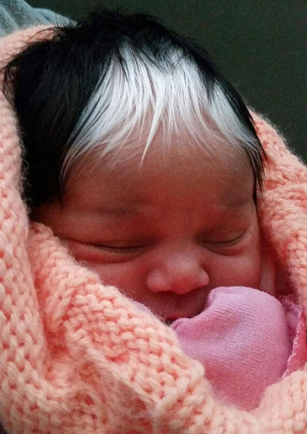 نوزادی با موهای سفید