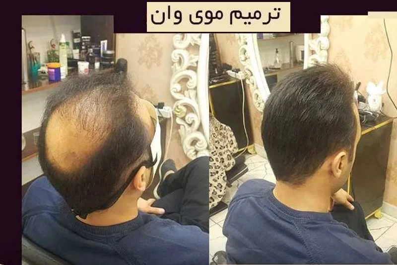 پوست