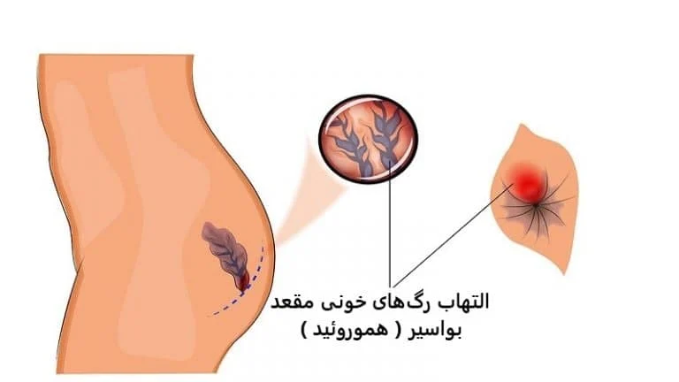 پوشاک | درمان