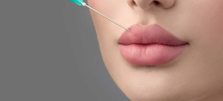 مراقبت های بعد از تزریق ژل لب