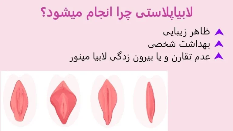 لابیاپلاستی با لیزر چیست؟ + معرفی بهترین پزشک لابیاپلاستی با لیزر در تهران