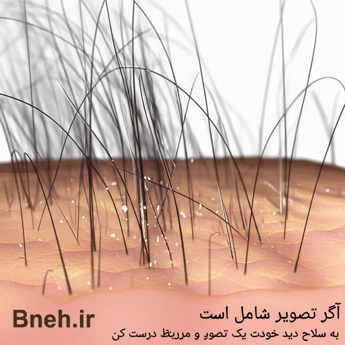 آرایش | پوست
