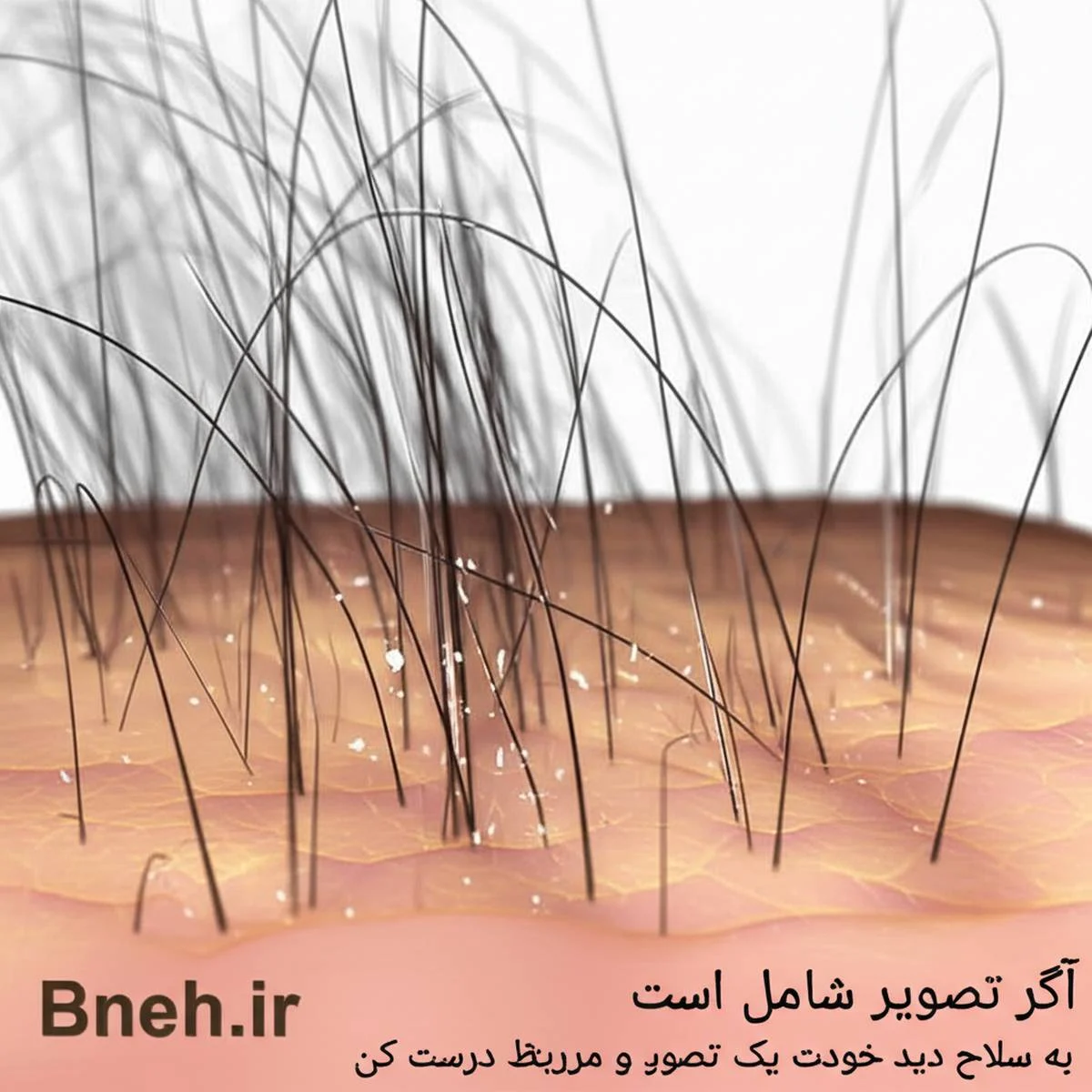 روغن درخت چای