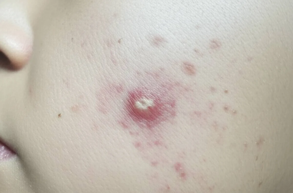 پوست صورت