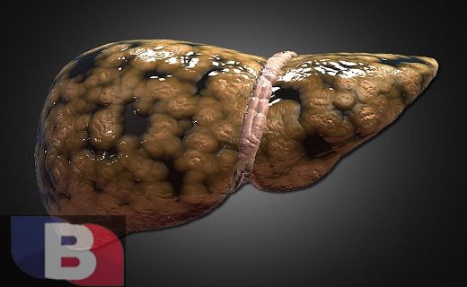 آزمایش خون | پوست