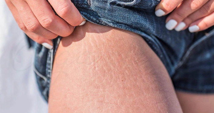 استرس | بارداری